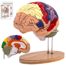 DSFGFRR brain model 2X life-size shows key structures for labs and classrooms clearly.