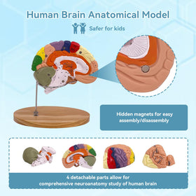 DSFGFRR model uses color-coded sections to distinguish brain regions at a glance.
