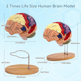 DSFGFRR brain model features laser-engraved labels for durable, legible identification.