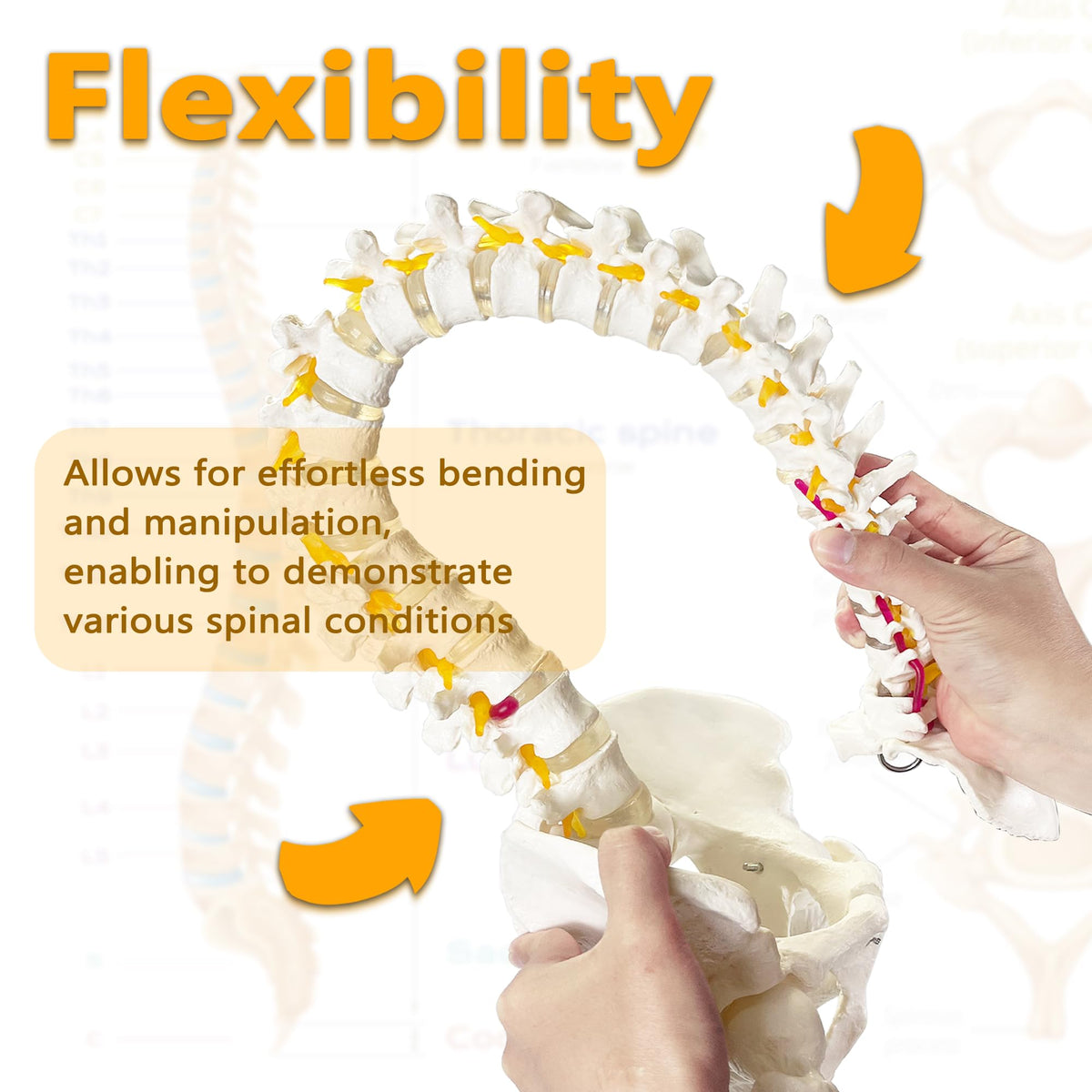 Koretech spine model 34.6 illustrating herniated disc at L4-L5