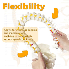 Koretech spine model 34.6 illustrating herniated disc at L4-L5