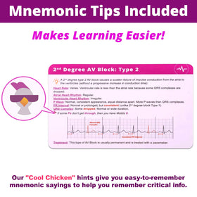 Level Up RN EKG flash cards mnemonic tips support memory recall.