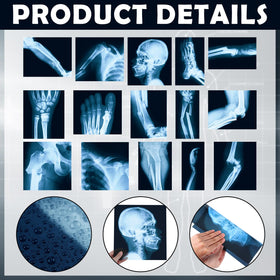 Sayglossy blue and black X-ray plates are lightweight and easy to handle