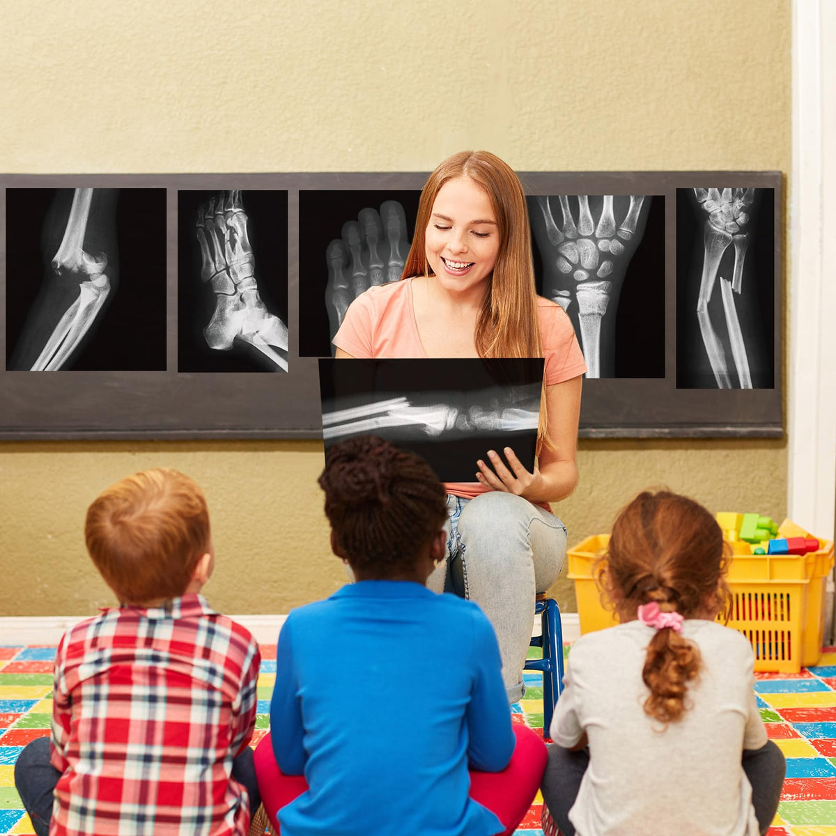 Sayglossy broken bones X-ray set contains 15 pieces for learning.