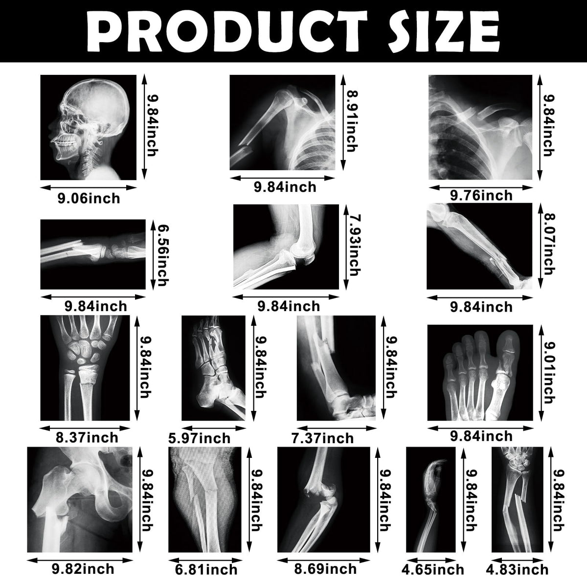 Sayglossy broken bones X-ray set large size, enables clear bone exploration.