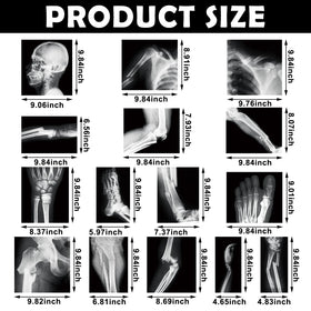 Sayglossy broken bones X-ray set large size, enables clear bone exploration.