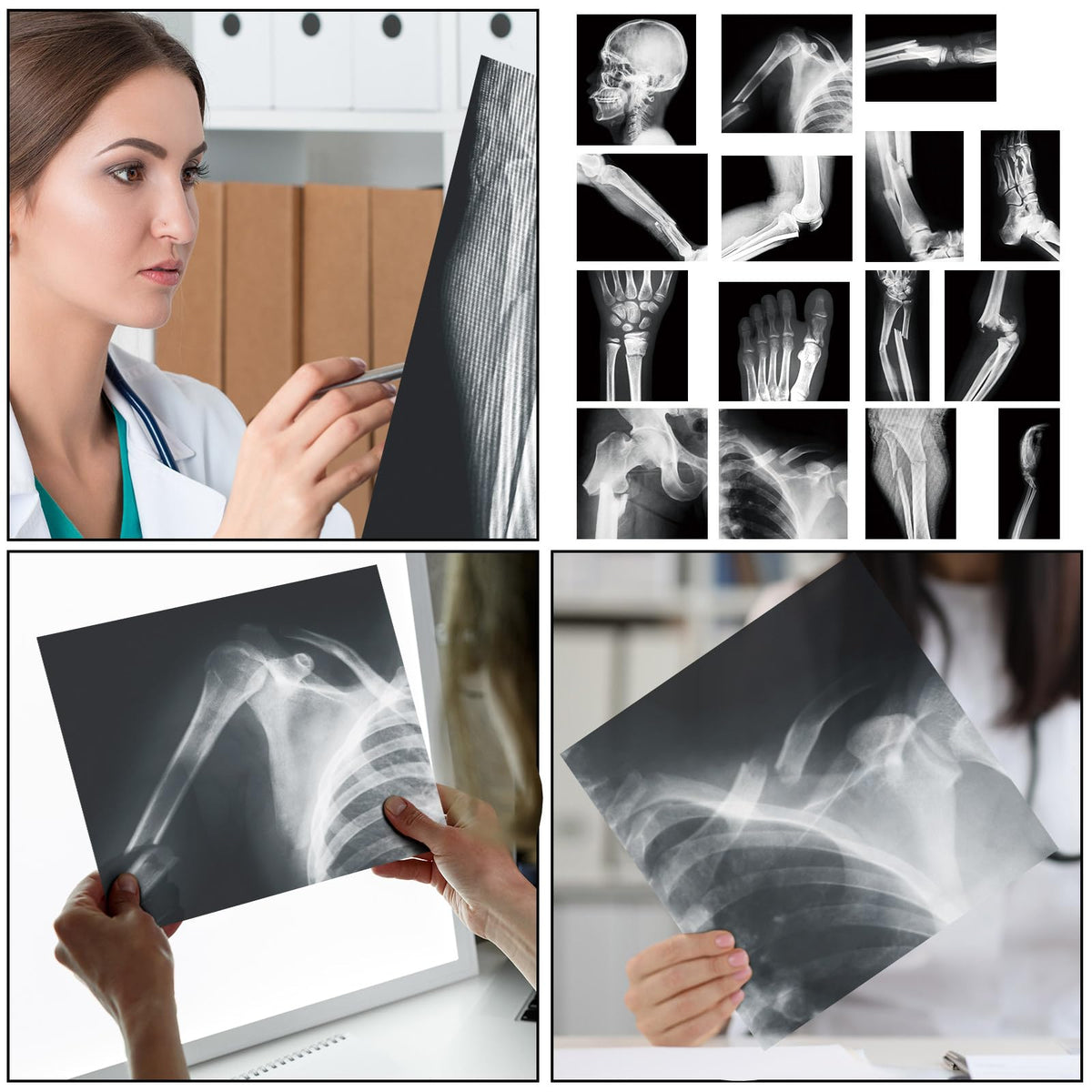 Sayglossy broken bones X-ray set PVC material for safety and durability.