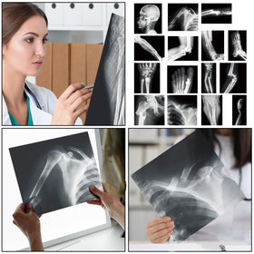 Sayglossy broken bones X-ray set PVC material for safety and durability.