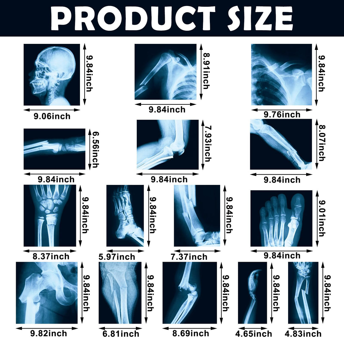 Sayglossy 20x25 cm X-ray cards provide clear viewing for kids
