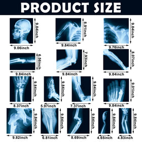 Sayglossy 20x25 cm X-ray cards provide clear viewing for kids
