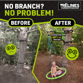 Trelines SkyStand no-branch setup enables backyard fun without tree limitations