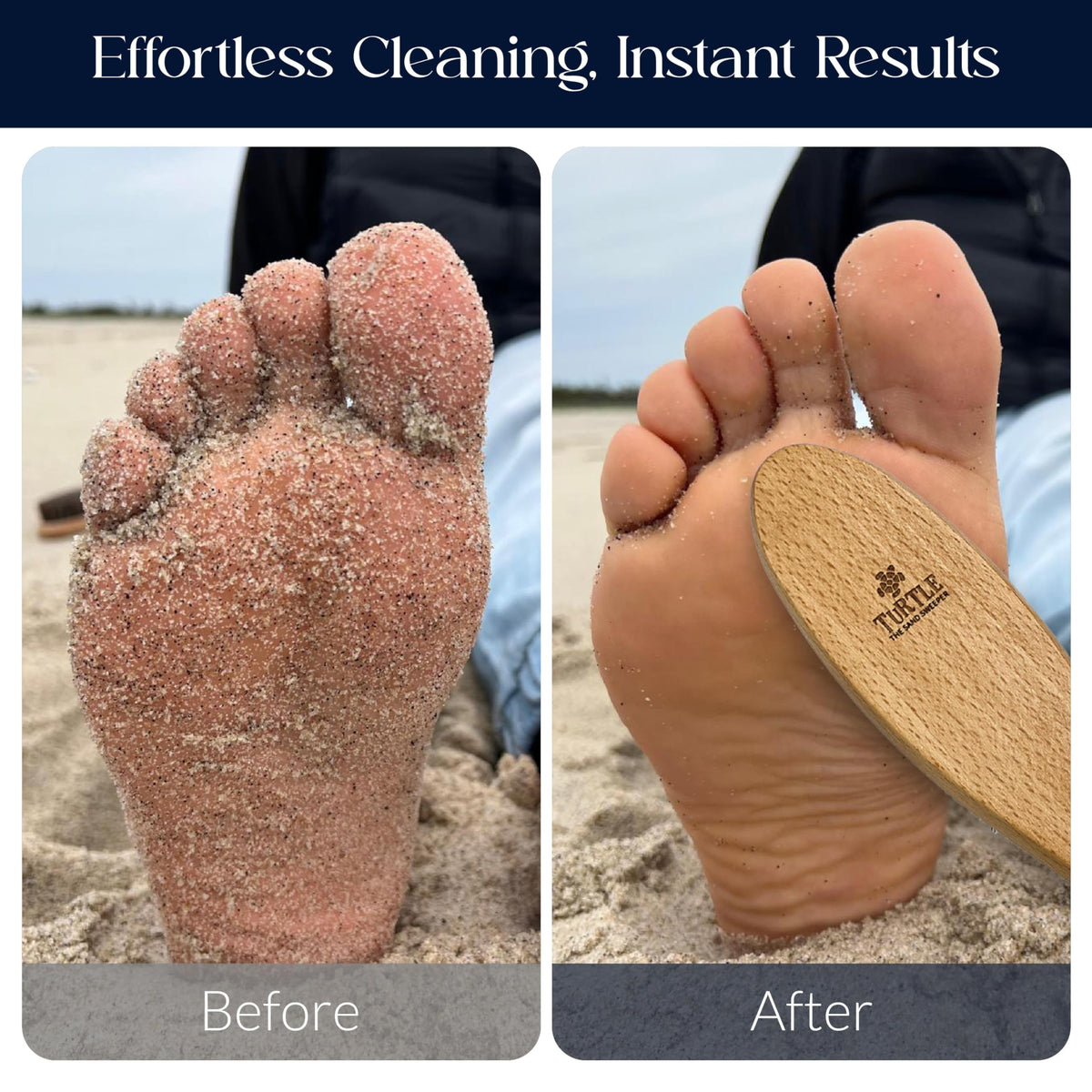 Turtle Sand Sweeper compact travel set for quick beach cleanup.