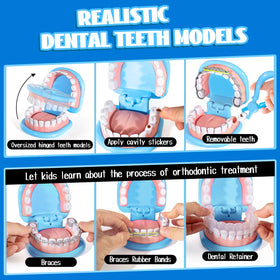 ULOVEME dental tools set includes braces and retainer for pretend dental work.